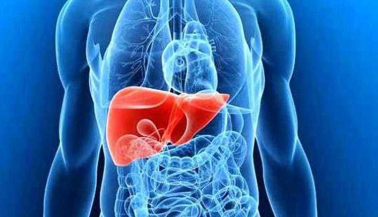 شیوع کبد چرب به دلیل سبک زندگی جدید افزایش یافته است