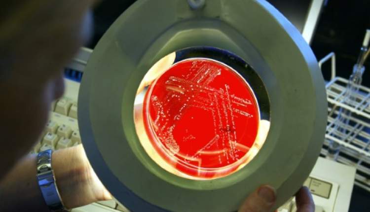 پیامدهای باکتریهای مقاوم در برابر دارو فاجعه بار است پیامدهای باکتریهای مقاوم در برابر دارو فاجعه بار است