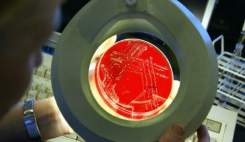 پیامدهای باکتریهای مقاوم در برابر دارو فاجعه بار است پیامدهای باکتریهای مقاوم در برابر دارو فاجعه بار است