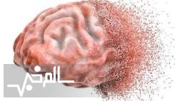 آهسته راه رفتن نشانه ابتلا به زوال عقل است