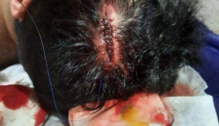 ضرب و شتم یک پزشک پس از ۱۸ ماه خدمت بی‌پشتوانه؛ دانشگاه علوم پزشکی ایرانشهر همچنان در سکوت!