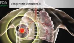 تأیید شتاب‌یافته FDA برای داروی zongertinib ؛ امید تازه بیماران مبتلا به سرطان ریه
