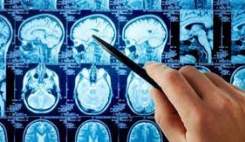 داروی جدید تومورهای مغزی "تینستاموستین" در فهرست داروهای اورفان قرار گرفت داروی جدید تومورهای مغزی "تینستاموستین" در فهرست داروهای اورفان قرار گرفت